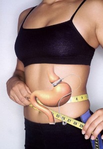 hypno gastric band