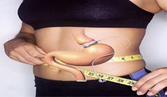 lose weight with a hypnotic gastric band